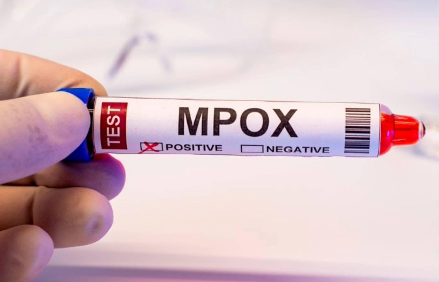 MPOX - DF em 2026; saiba mais sobre a doença